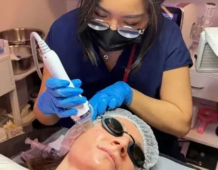 Microneedling Combination Service