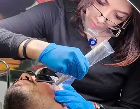 Microneedling Scar Reduction Service