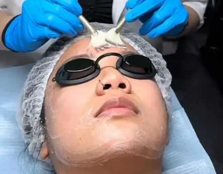 Express Treatment Service